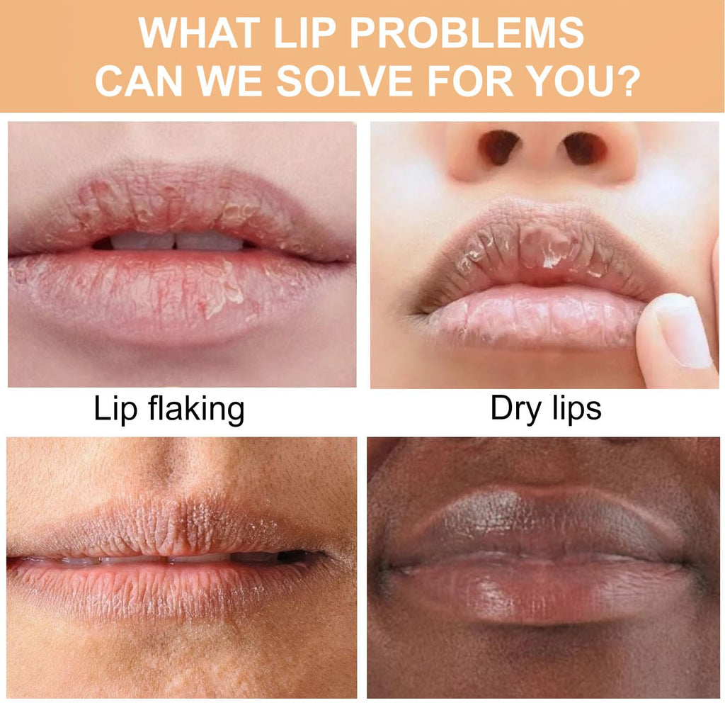 Turmeric Lip Balm for Smokers With Root Oil - Brightening for Dark Lips, Long-Lasting Moisturizer for Dry