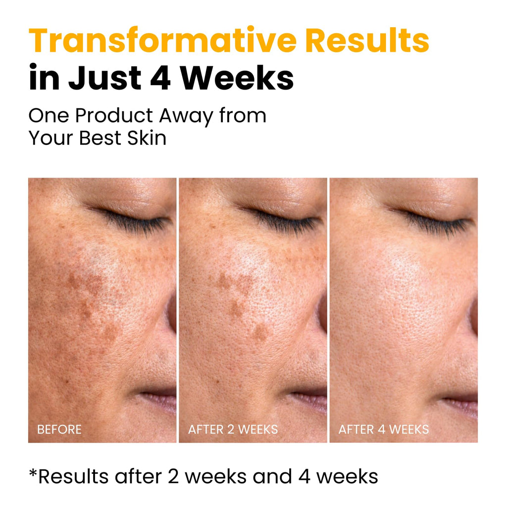 QUIA Turmeric + Kojic Acid Overnight Wrapping Mask – Hydration Mask for Glowing Skin