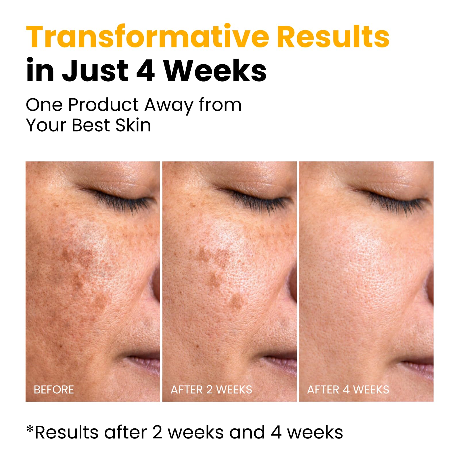 QUIA Turmeric + Kojic Acid Overnight Wrapping Mask – Hydration Mask for Glowing Skin