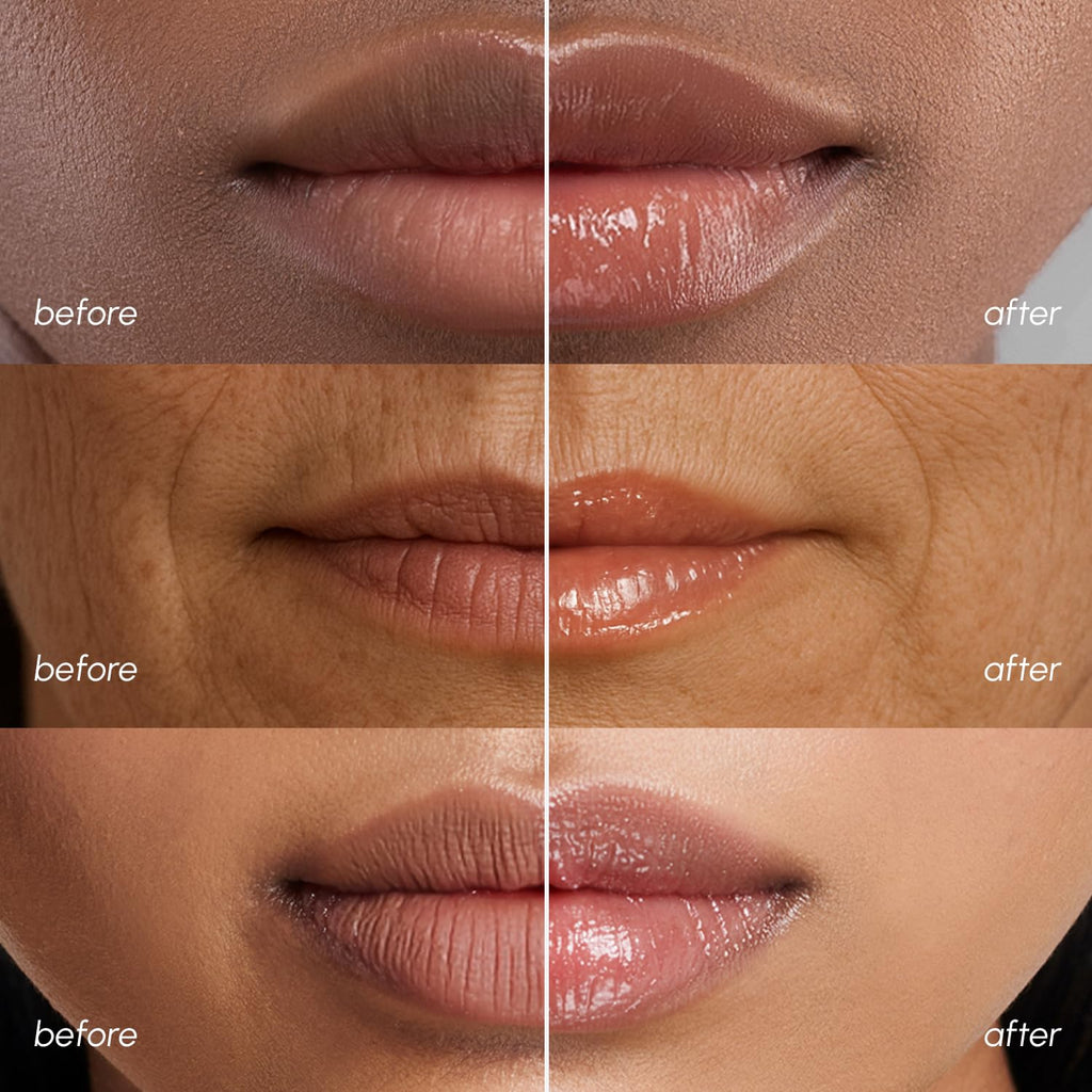 MAREE Lip Mask Overnight - Lip Moisturizer For Very Dry Lips - Hydrating Lip Butter Balm with Hyaluronic Acid & Collagen