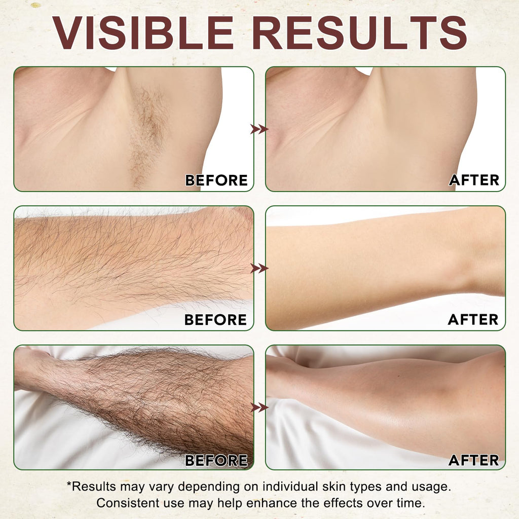 Cyperus Rotundus Oil, Natural for Reducing Body Hair Growth, Cyperus Rotundus Oil for Hair