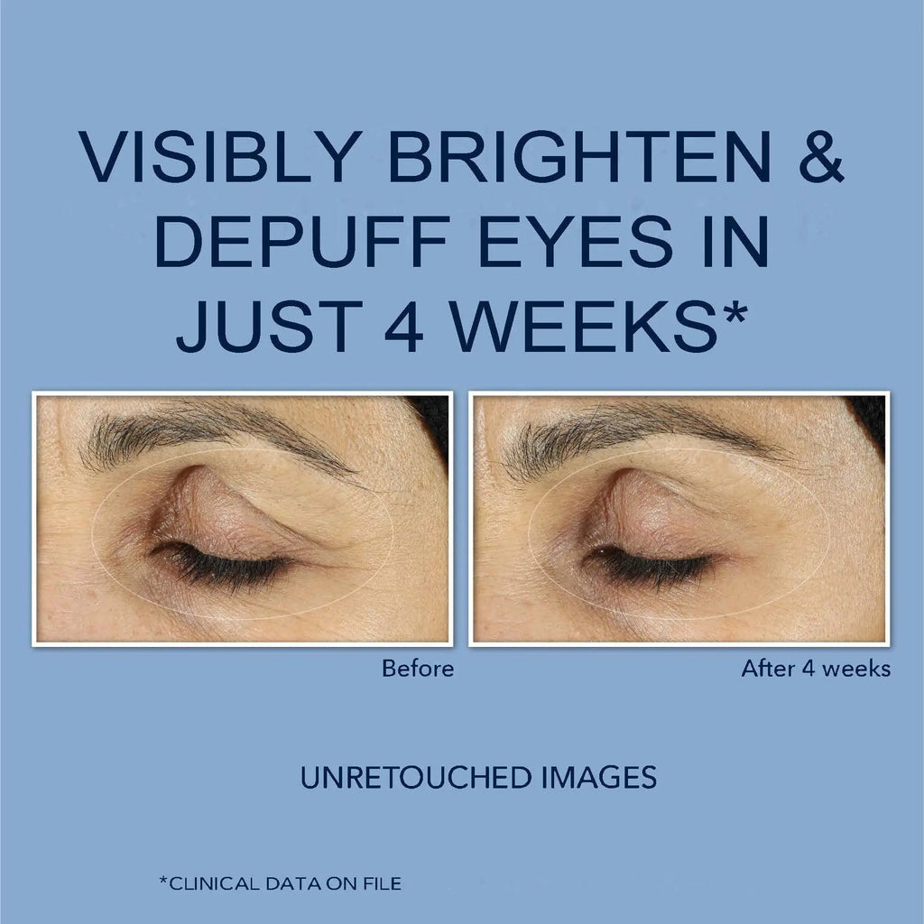 RoC Retinol Correxion Under Eye Cream for Dark Circles & Puffiness, Daily Wrinkle RoC Au supplements