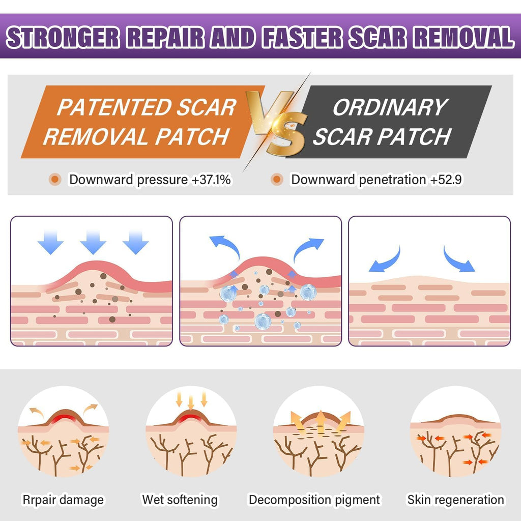 Silicone Scar Sheets,Silicone Scar Tape,Silicone Scar Removal Strips for Surgical,C-Section,Tummy Tuck,Keloid Scars