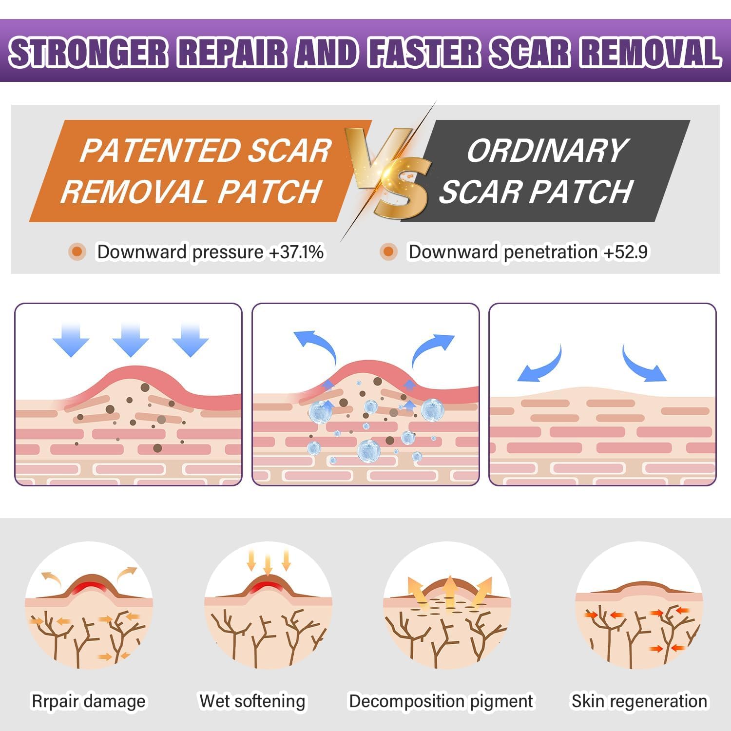 Silicone Scar Sheets,Silicone Scar Tape,Silicone Scar Removal Strips for Surgical,C-Section,Tummy Tuck,Keloid Scars