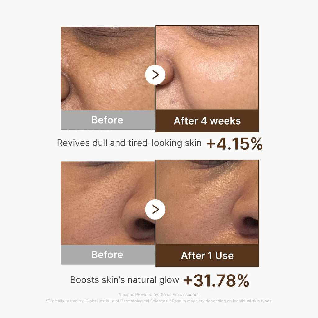 medicube Deep Vitamin C Capsule Serum | Hydrating Vitamin C Serum for Dull & Uneven-Looking Skin with Visible Concerns