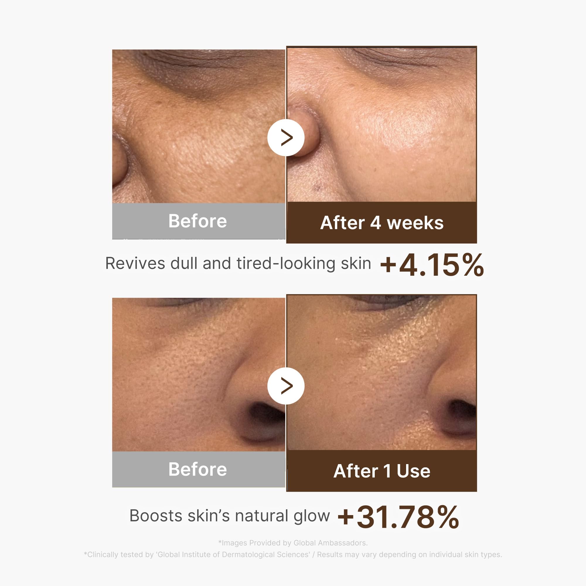 medicube Deep Vitamin C Capsule Serum | Hydrating Vitamin C Serum for Dull & Uneven-Looking Skin with Visible Concerns
