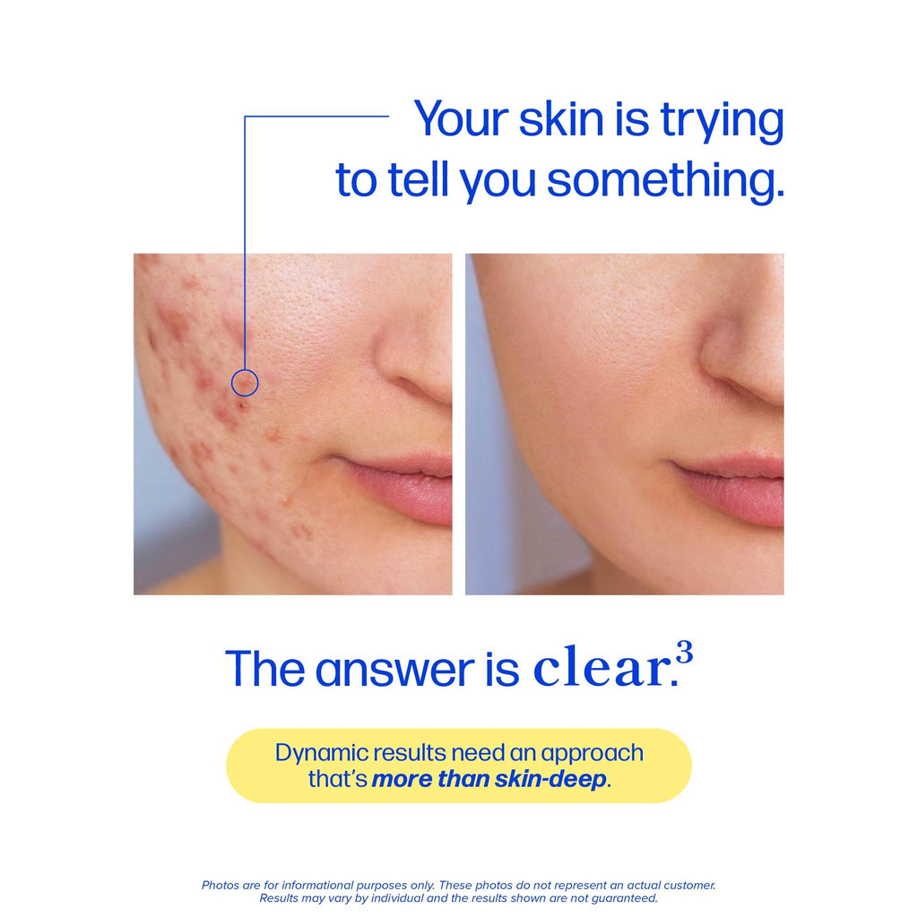 Clear Skin Supplement with Zinc, DIM & Probiotics | 3-in-1 Balance, Glow & Health Skin Support | Triple Action Hyaluronic Acid, Niaciminide & Vitamins for Hormone