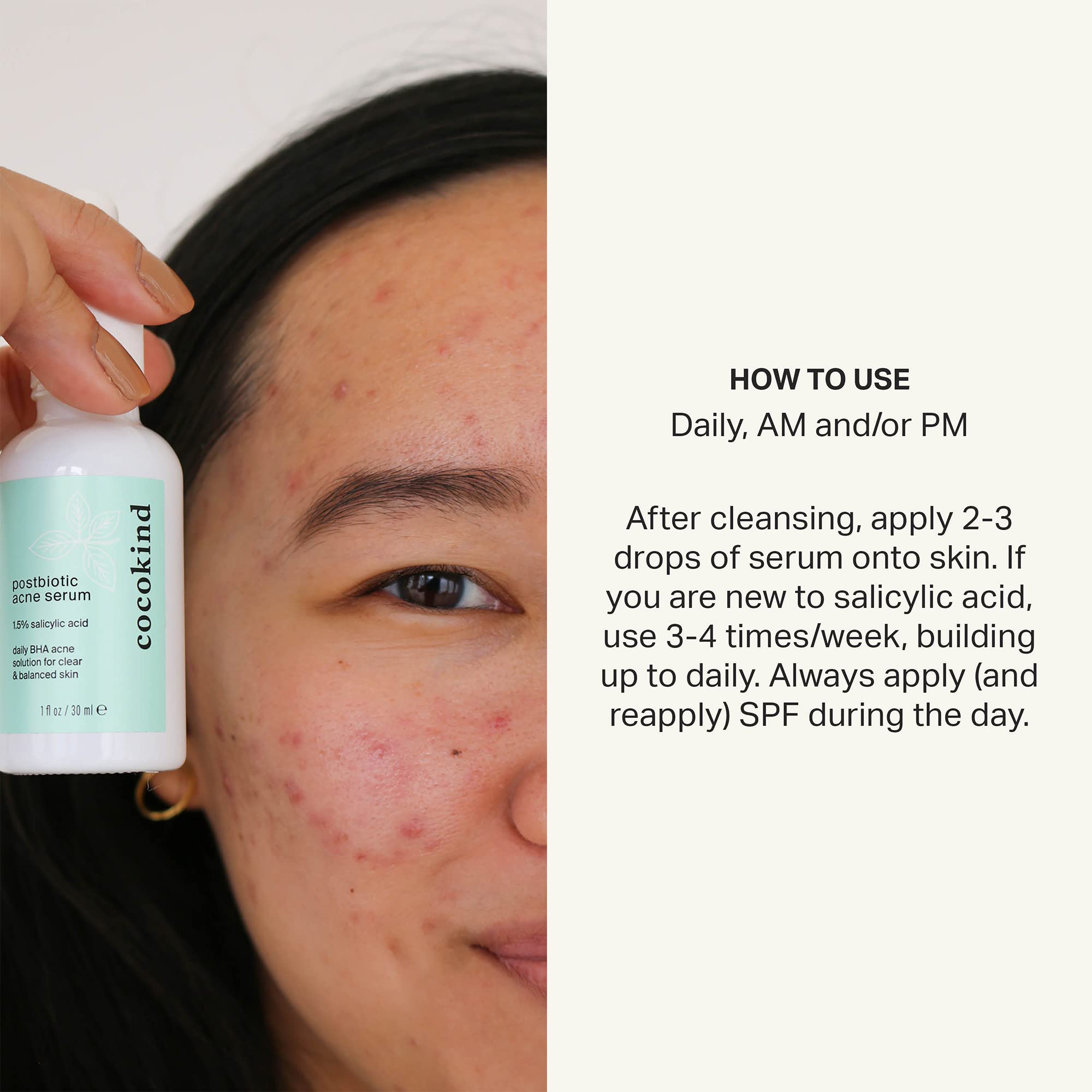 Cocokind Postbiotic Acne Serum, Salicylic Acid Serum and BHA Liquid Exfoliant - Exfoliating, Brightening and Hydrating Serum Cocokind Au supplements