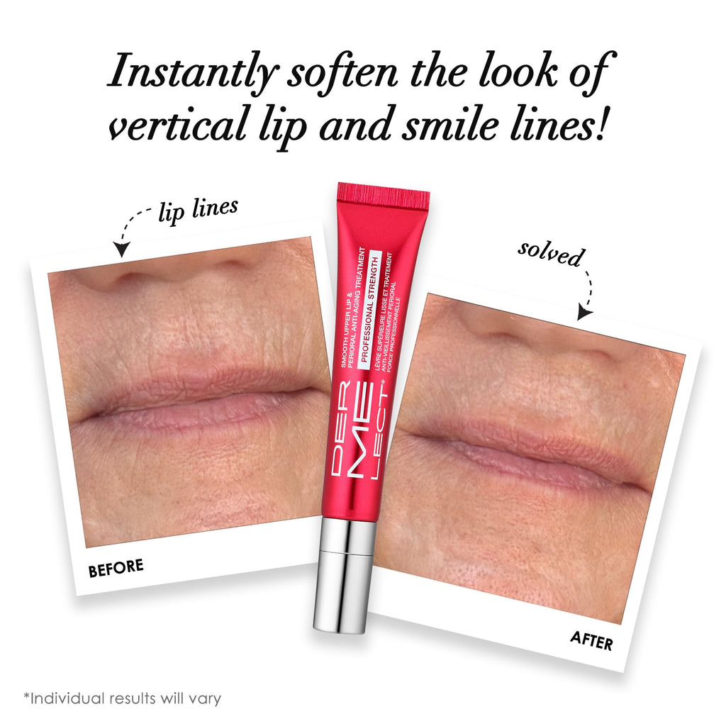 Dermelect Smooth Upper Lip & Perioral Anti-Aging Treatment - Professional Strength 15ml