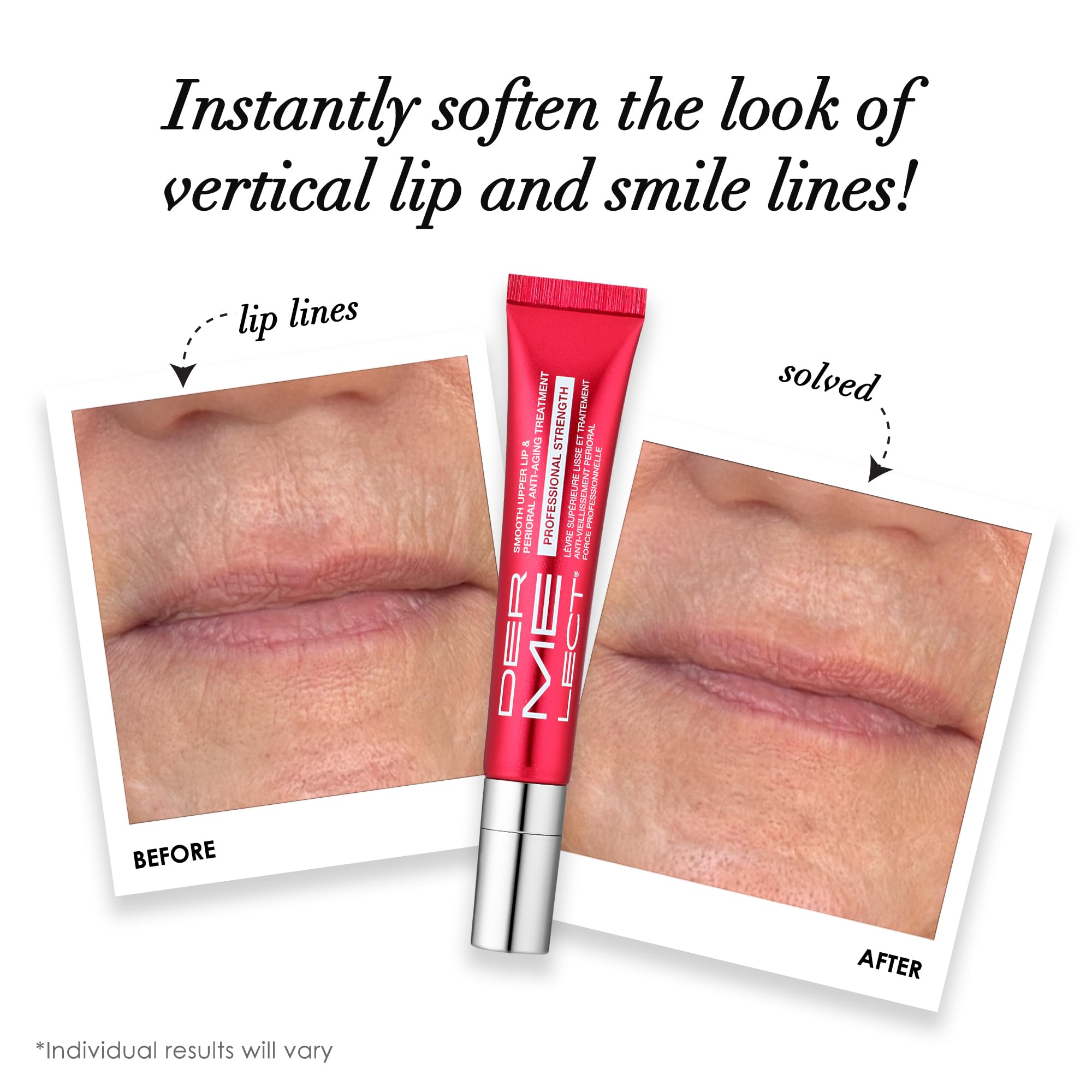 Dermelect Smooth Upper Lip & Perioral Anti-Aging Treatment - Professional Strength 15ml