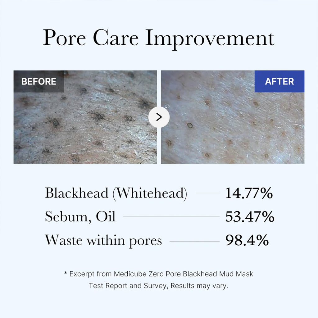 Medicube Zero Pore Blackhead Mud Facial Mask - Skin Cooling & Pore Tightening - 3 Minute Quick Dry Formula with AHA, BHA, PHA