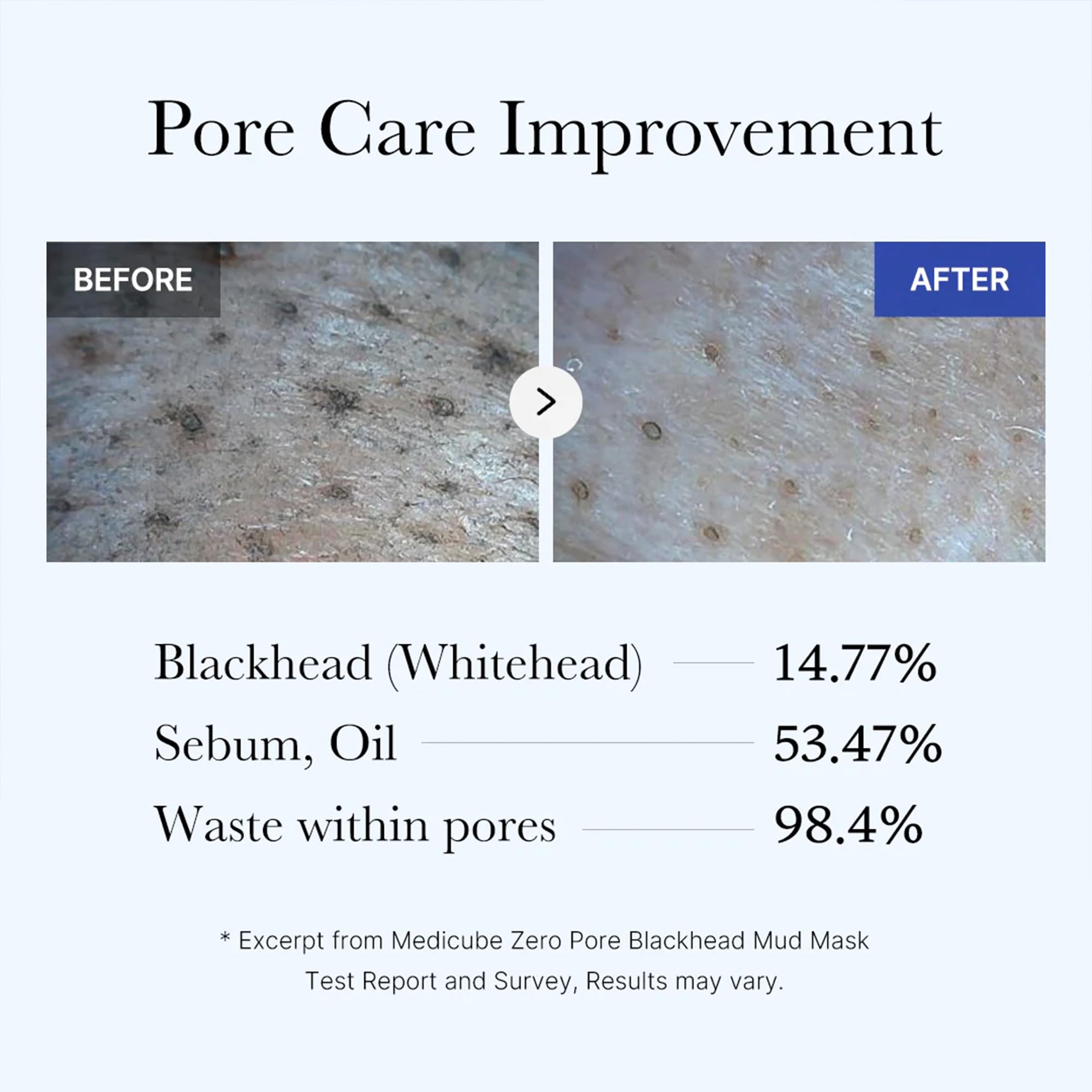 Medicube Zero Pore Blackhead Mud Facial Mask - Skin Cooling & Pore Tightening - 3 Minute Quick Dry Formula with AHA, BHA, PHA
