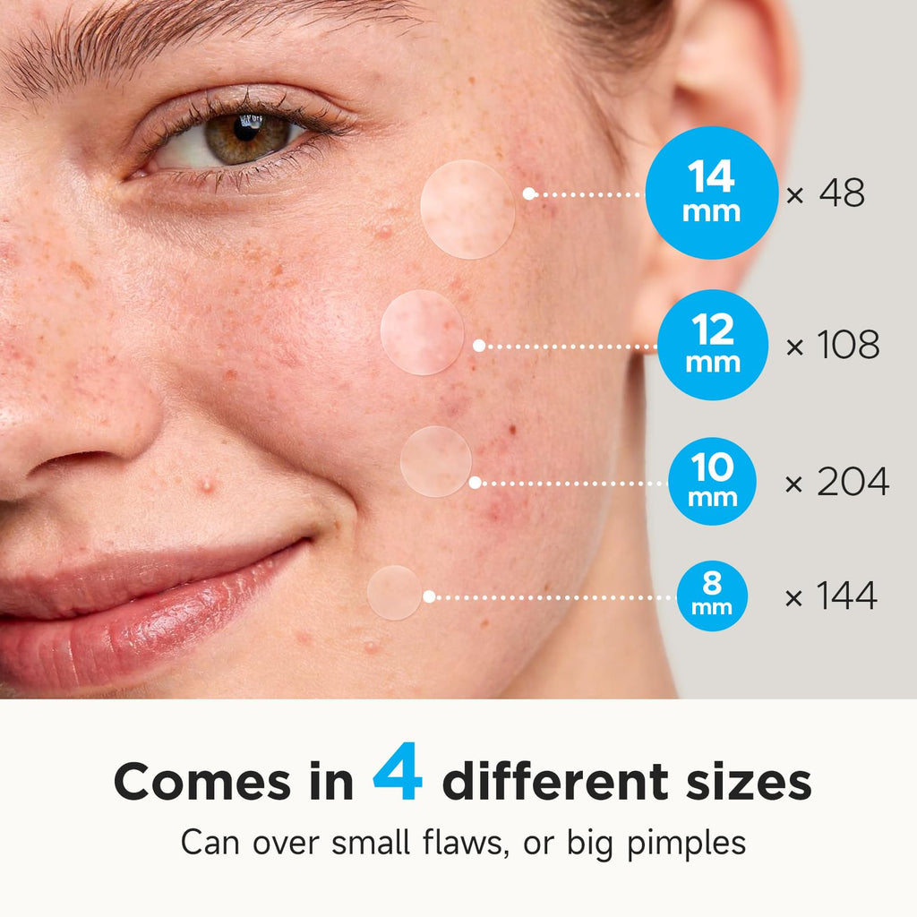 Glowpatch Pimple Patches for Face (504 Count), FSA Eligible Acne Patch Bulk, Zit Stickers 4 Sizes, Hydrocolloid Spot Stickers