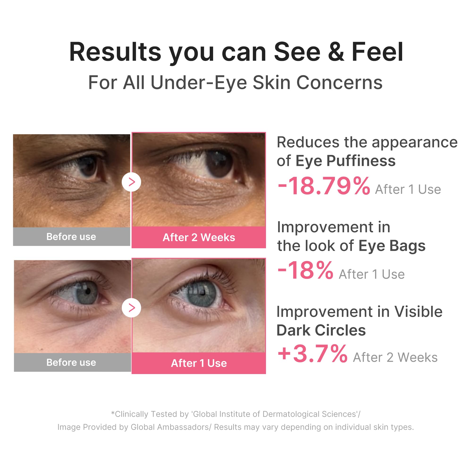 medicube PDRN Caffeine Collagen Eye Patch | Gel Eye Patches for the appearance of Dark Circles, Undereye Bags
