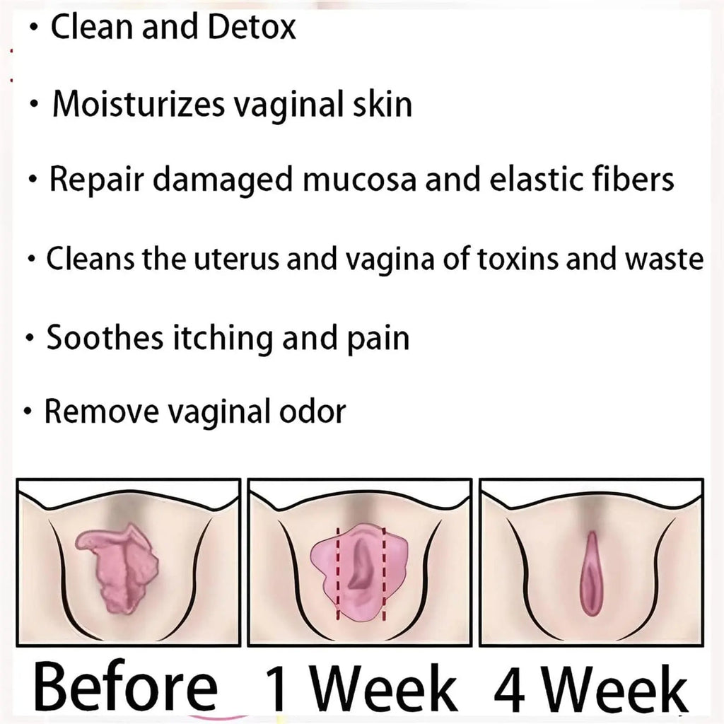 Dexcara Detox Repair, AnnieCare Natural Repair Vaginal Capsules, Anniecare Instant Anti YeeKeniO Au supplements