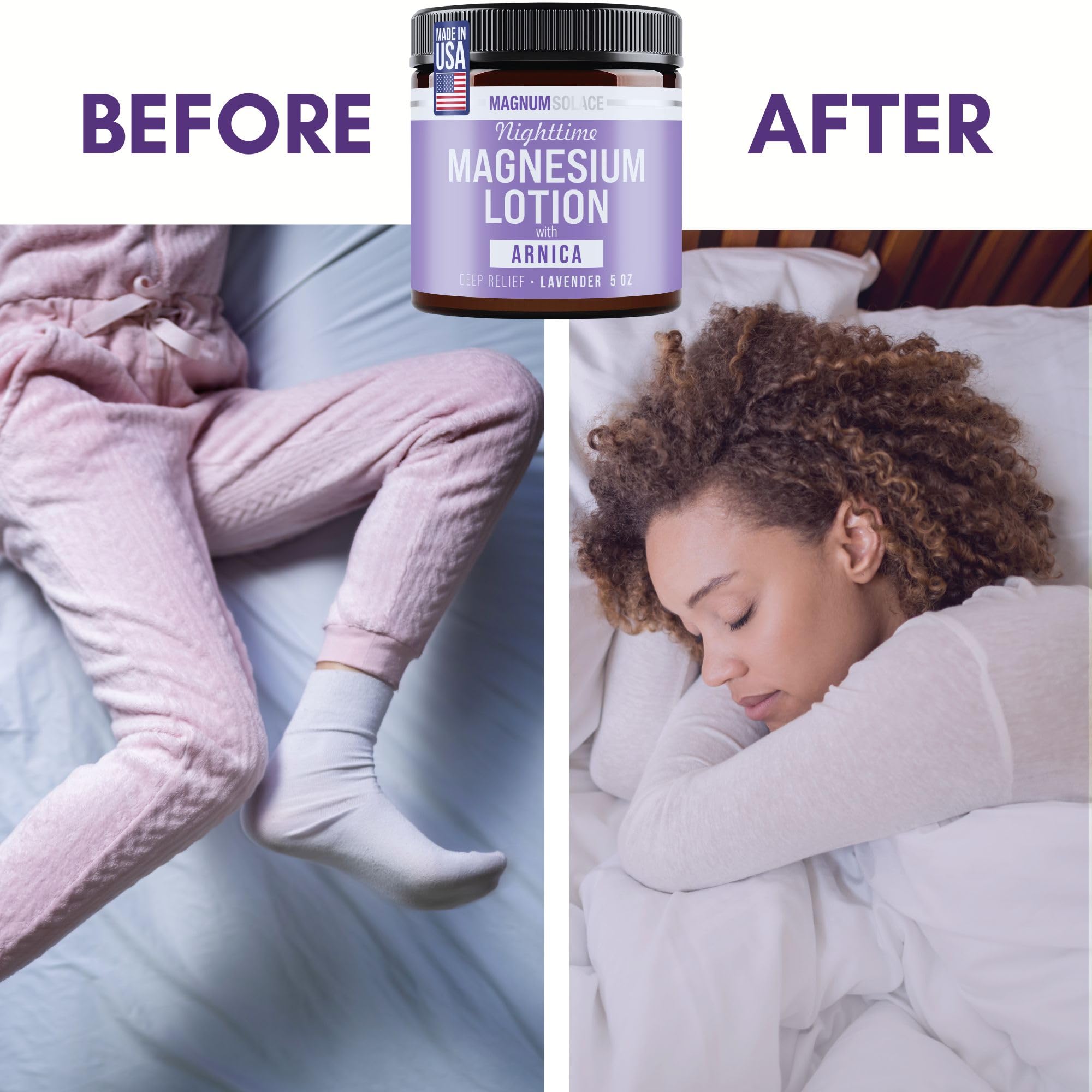 Magnum Solace Nighttime Magnesium Lotion with Arnica – Highly Concentrated Magnesium