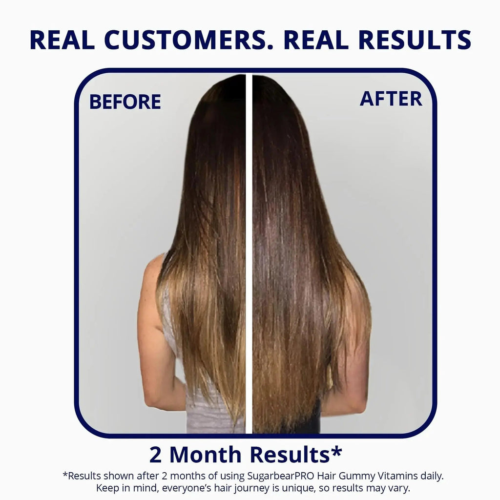 SugarBearPro Hair Vitamin Gummy 3 Month Supply Extra Strength Biotin 6000mcg, Growth for Men & Women, Vegan Vitamin B12 SugarBearHair Au supplements