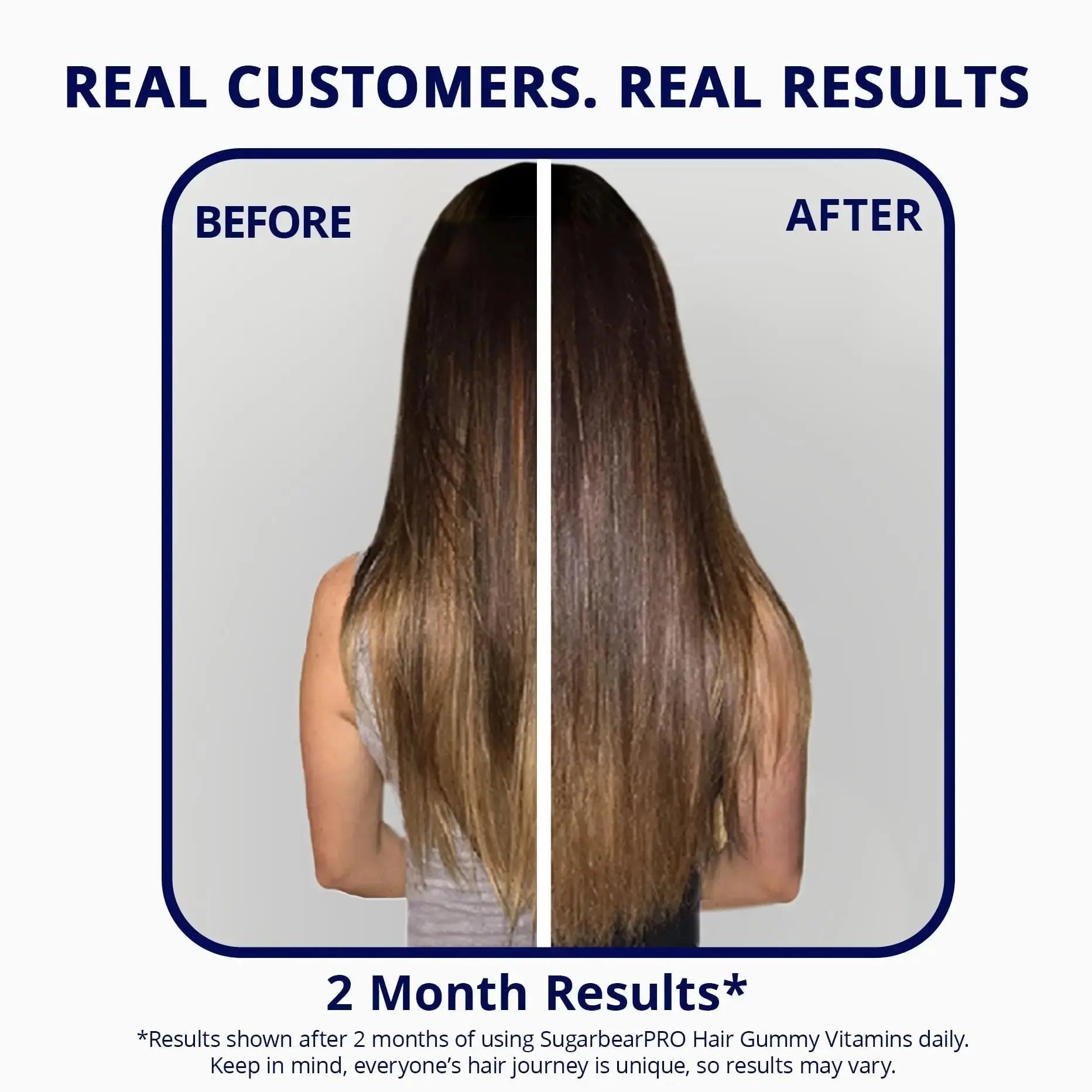 SugarBearPro Hair Vitamin Gummy 3 Month Supply Extra Strength Biotin 6000mcg, Growth for Men & Women, Vegan Vitamin B12 SugarBearHair Au supplements