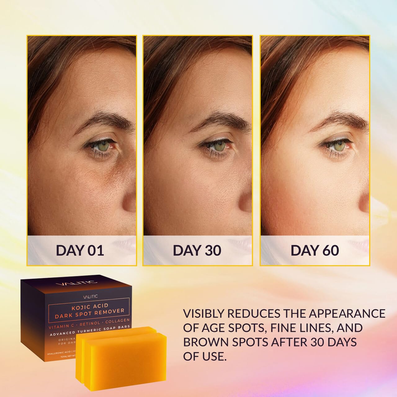 VALITIC Kojic Acid Dark Spot Remover Soap Bars with Vitamin C, Retinol, Collagen, Turmeric