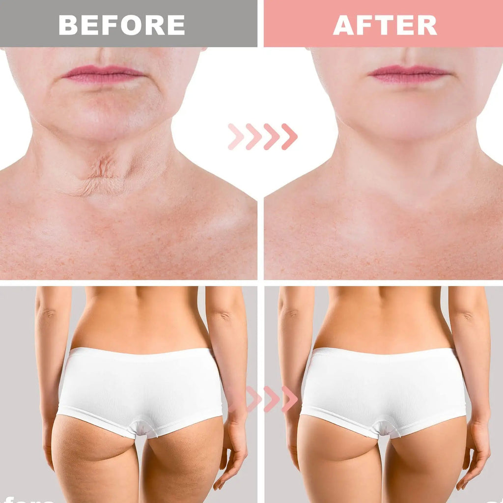 Hibiscus and Honey Firming Cream, Skin Tightening Lotion, Reduces the Look of Neck Lines CITYGOO Au supplements