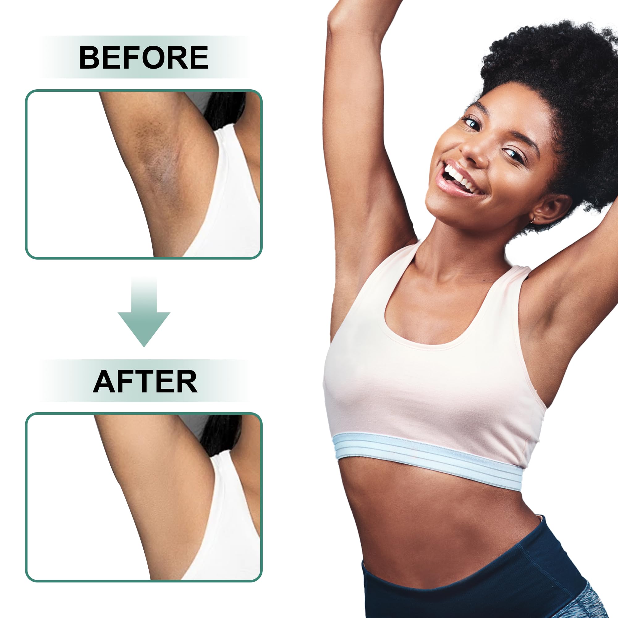 Vcetree Skin Bleaching Cream Skin Lightening for Body Intimate Areas, Private Parts, Underarm, Knees, Elbows, Inner Thigh, Bikini Area