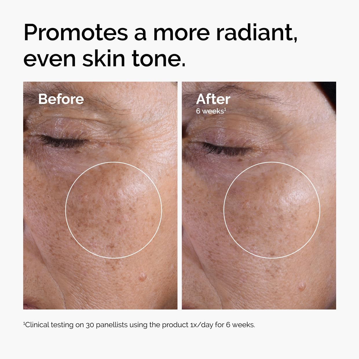The Ordinary Glycolic Acid 7% Exfoliating Toner, Brightening and Smoothing Daily Toner