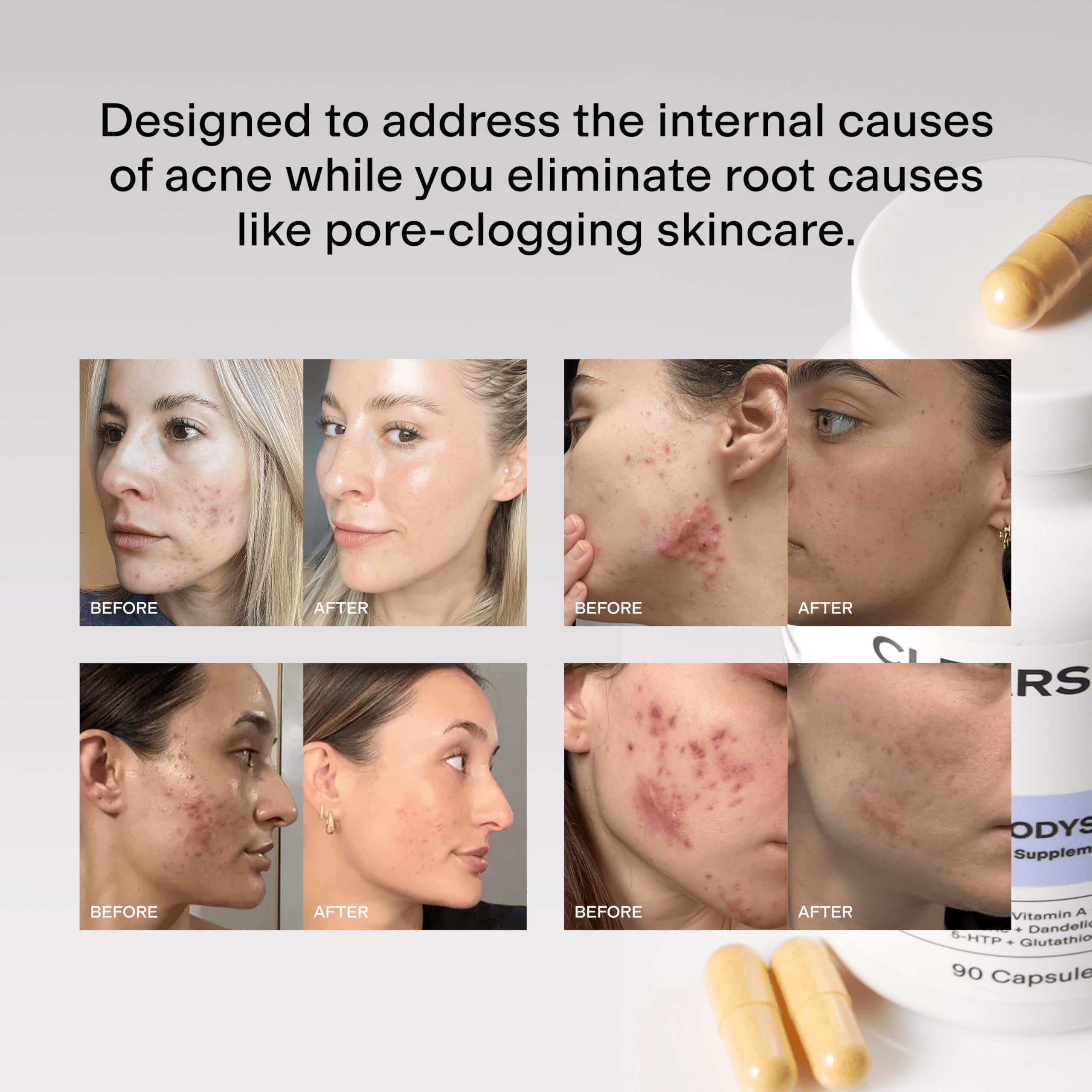 CLEARSTEM - MINDBODYSKIN Hormonal Acne Supplement (5-HTP) - Natural DIM Supplement - Skin Care Vitamins - Hormone Balance, Antioxidants - Gluten Free,