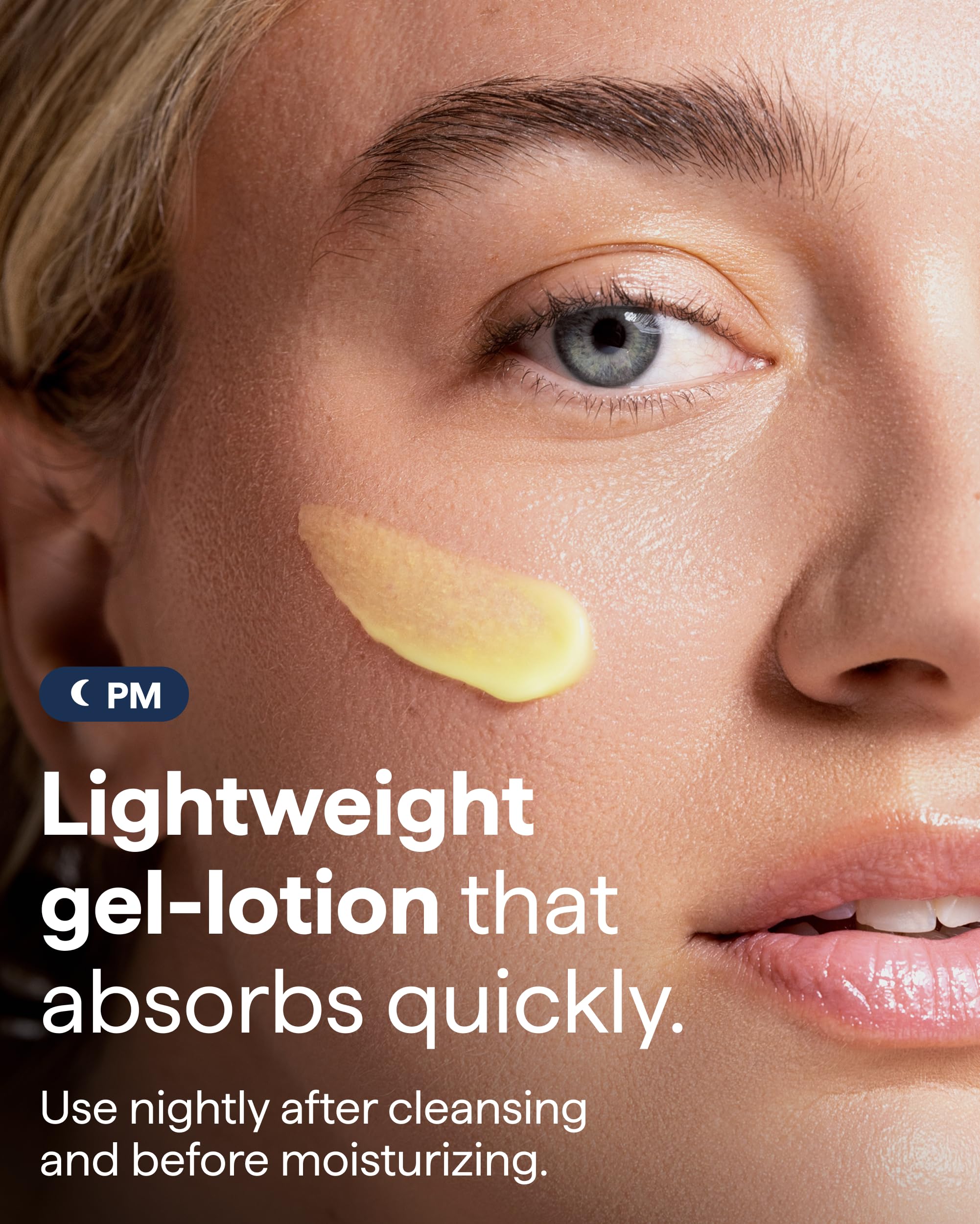 Remedy for Dark Spots | Advanced Night Treatment with Retinol & Kojic Acid | For Discoloration and Uneven Tones | With Glutathione