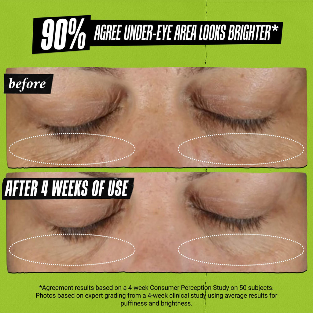 Kiehl's Avocado Eye Treatment, Nourishing and Hydrating Eye Cream, Avocado Oil and Caffeine to Energize and Invigorate Skin, Tired Eyes