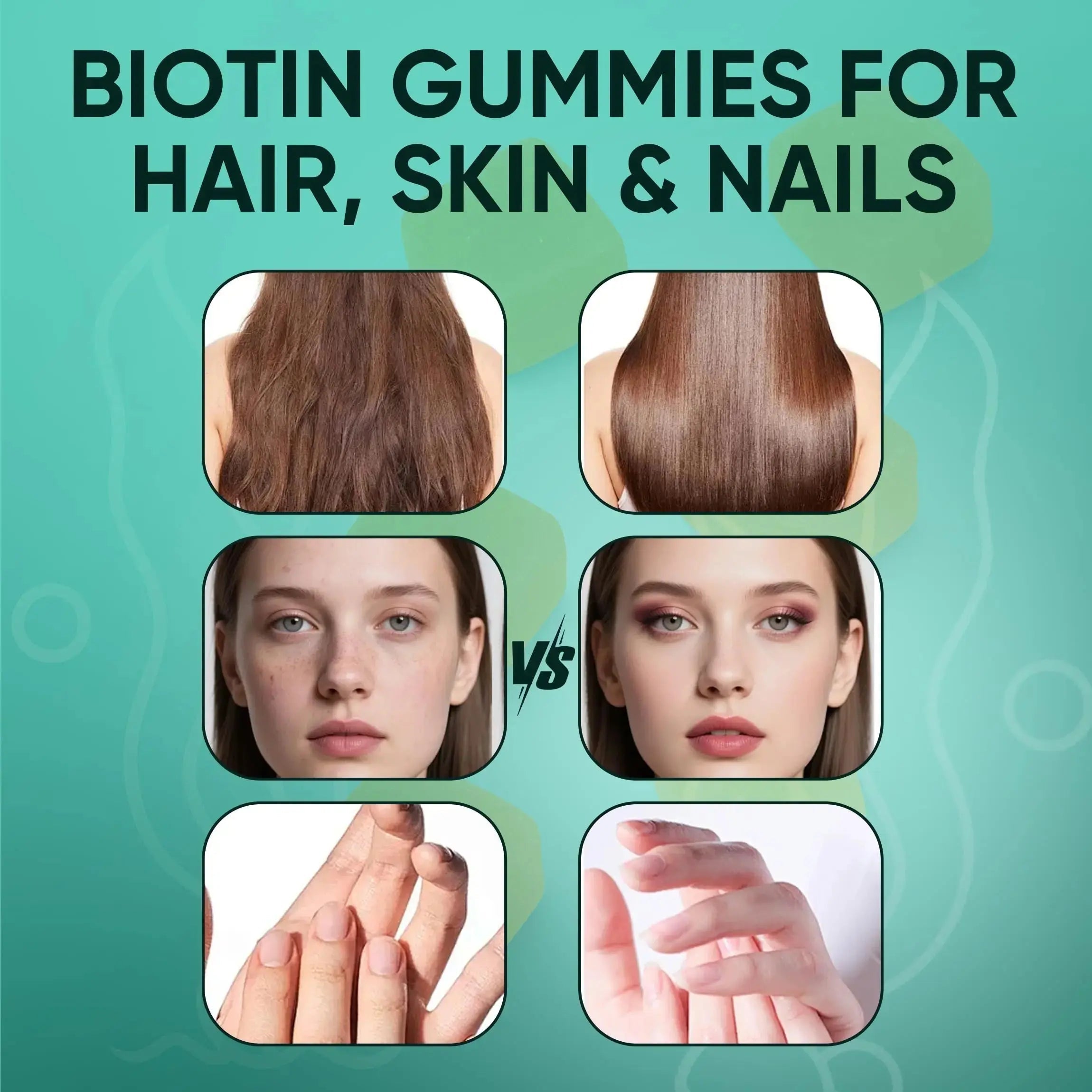 Neonomicon Balmbare Revive Gummies for Hair Loss - Sea Moss Gummies with Vitamin C, Vitamin E, Aloe Vera, Pearl Powder Supports Faster Hair Growth Neonomicon Au supplements