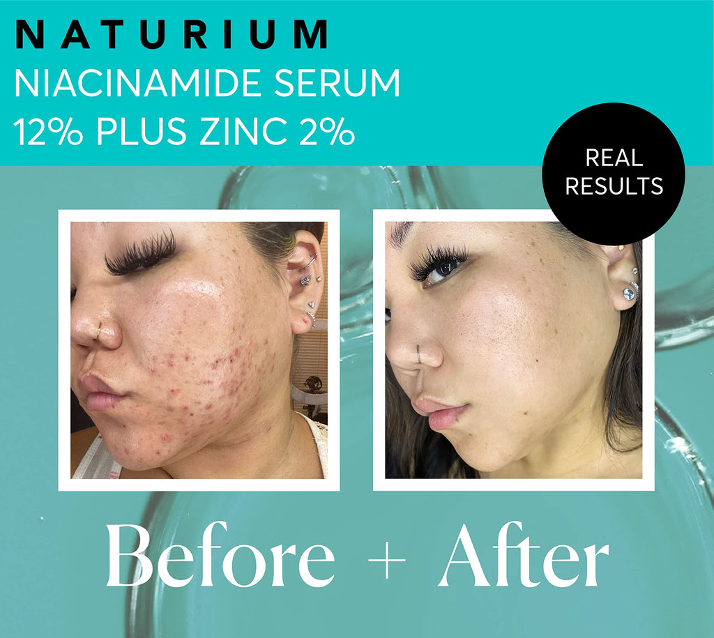 Naturium Niacinamide Face Serum 12% Plus Zinc 2%, Anti-Aging, Pore Minimizer & Dark Spot Corrector