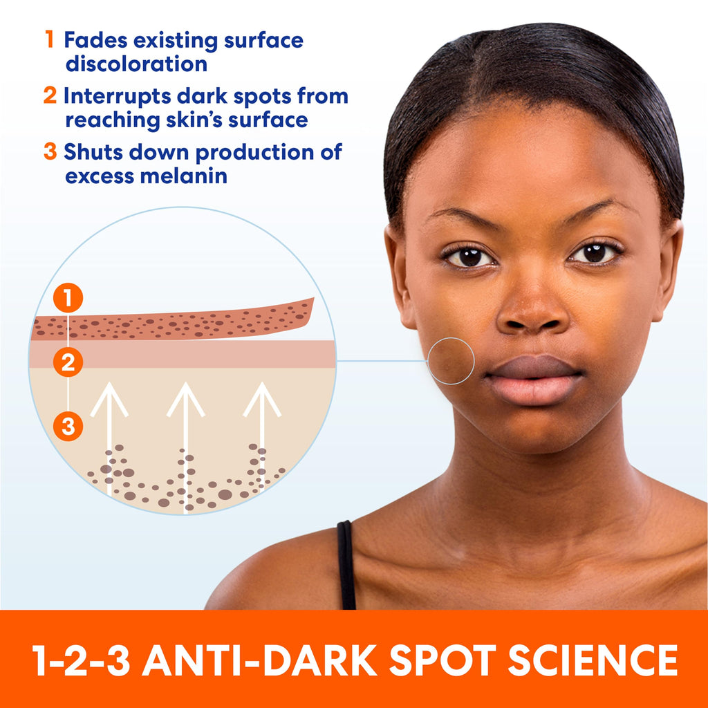 Palmer's Skin Success Anti-Dark Spot Fade Cream with Vitamin E and Niacinamide, for All Skin Types 2.7 Ounce