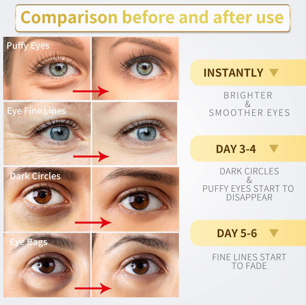 NAZANO 24K Gold Under Eye Patches - 60 Pack for Puffy Eyes, Dark Circles, Bags & Wrinkles