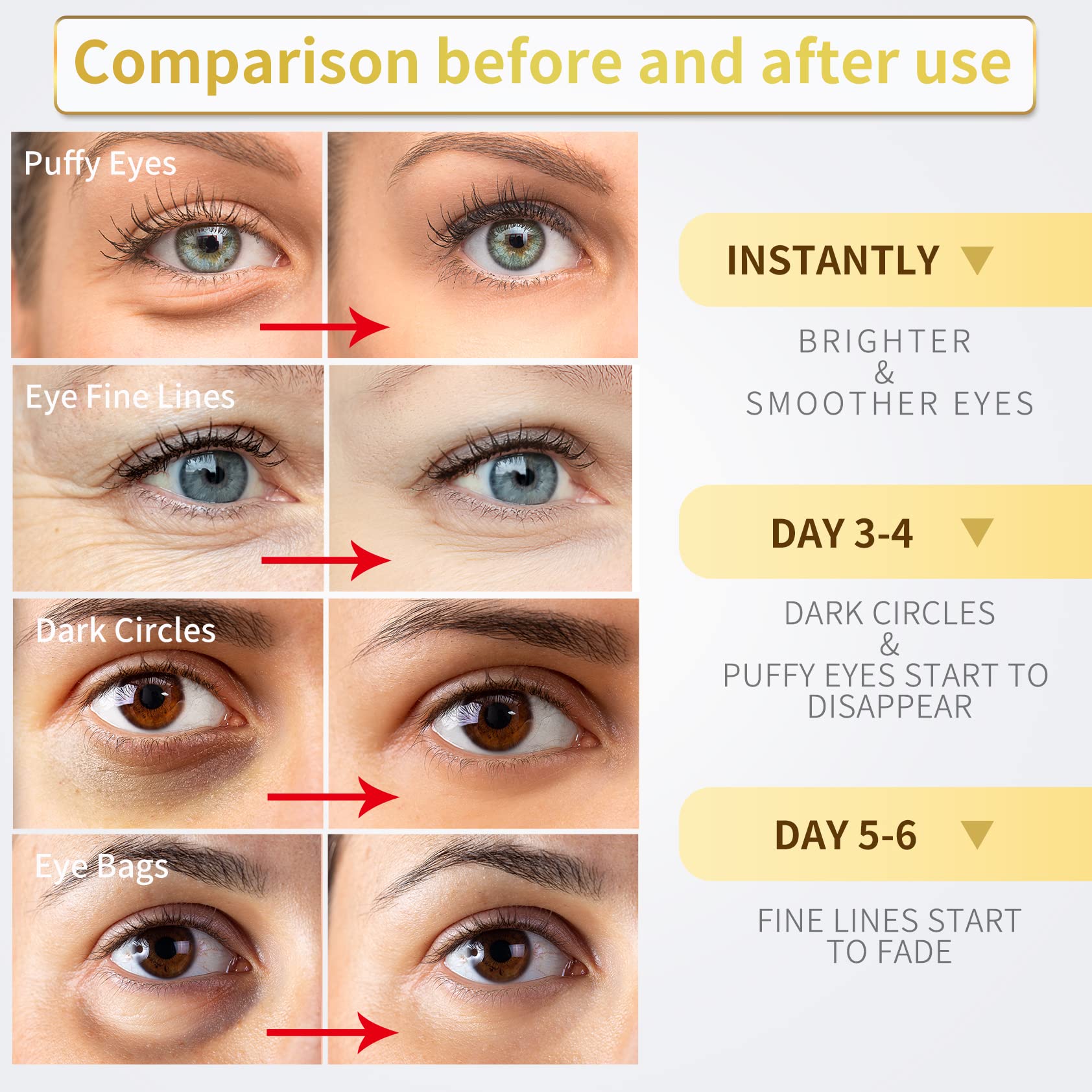 NAZANO 24K Gold Under Eye Patches - 60 Pack for Puffy Eyes, Dark Circles, Bags & Wrinkles