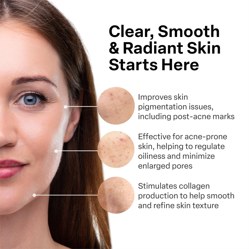 A313 French Pharmacy Vitamin A (Retinoids) Lightweight Face Cream for Anti-Aging, Reduce Wrinkles, Prevents Acne Breakouts