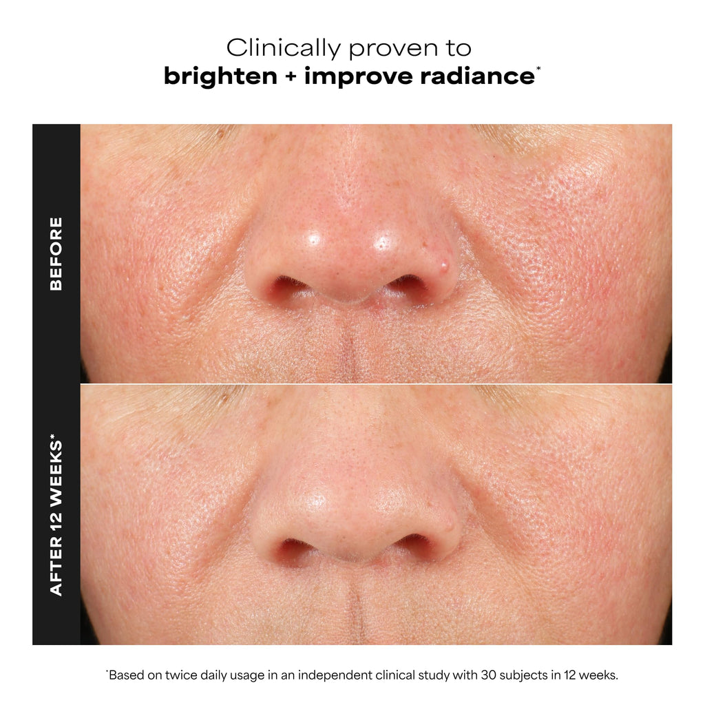 Paula's Choice BOOST C15 Super Booster, 15% Vitamin C Serum for Face, Face Serum with Vitamin E & Ferulic Acid