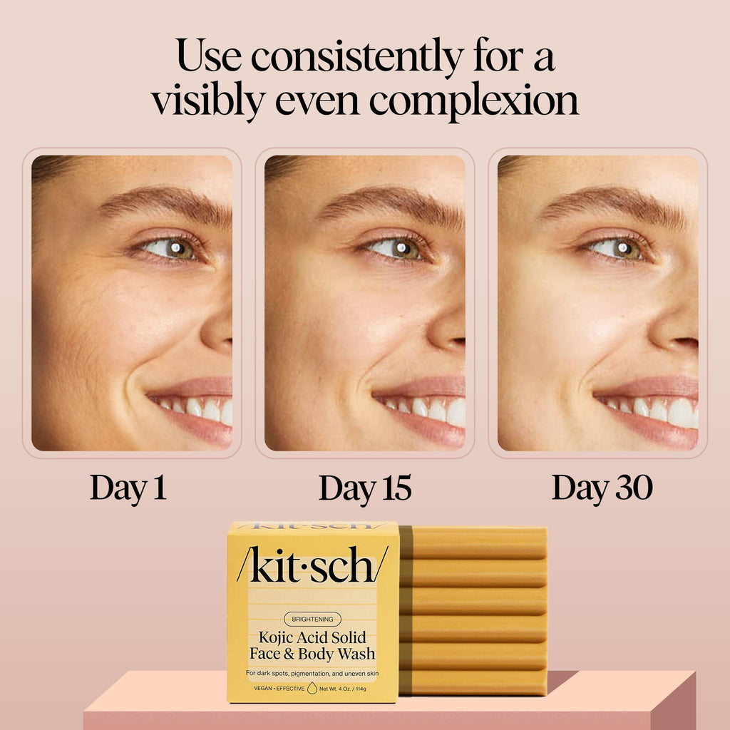 Kitsch Kojic Acid Soap – Turmeric Soap Bar with Hyaluronic Acid & Shea Butter – Brightening & Hydrating Body Wash & Face Wash for Dark Spots
