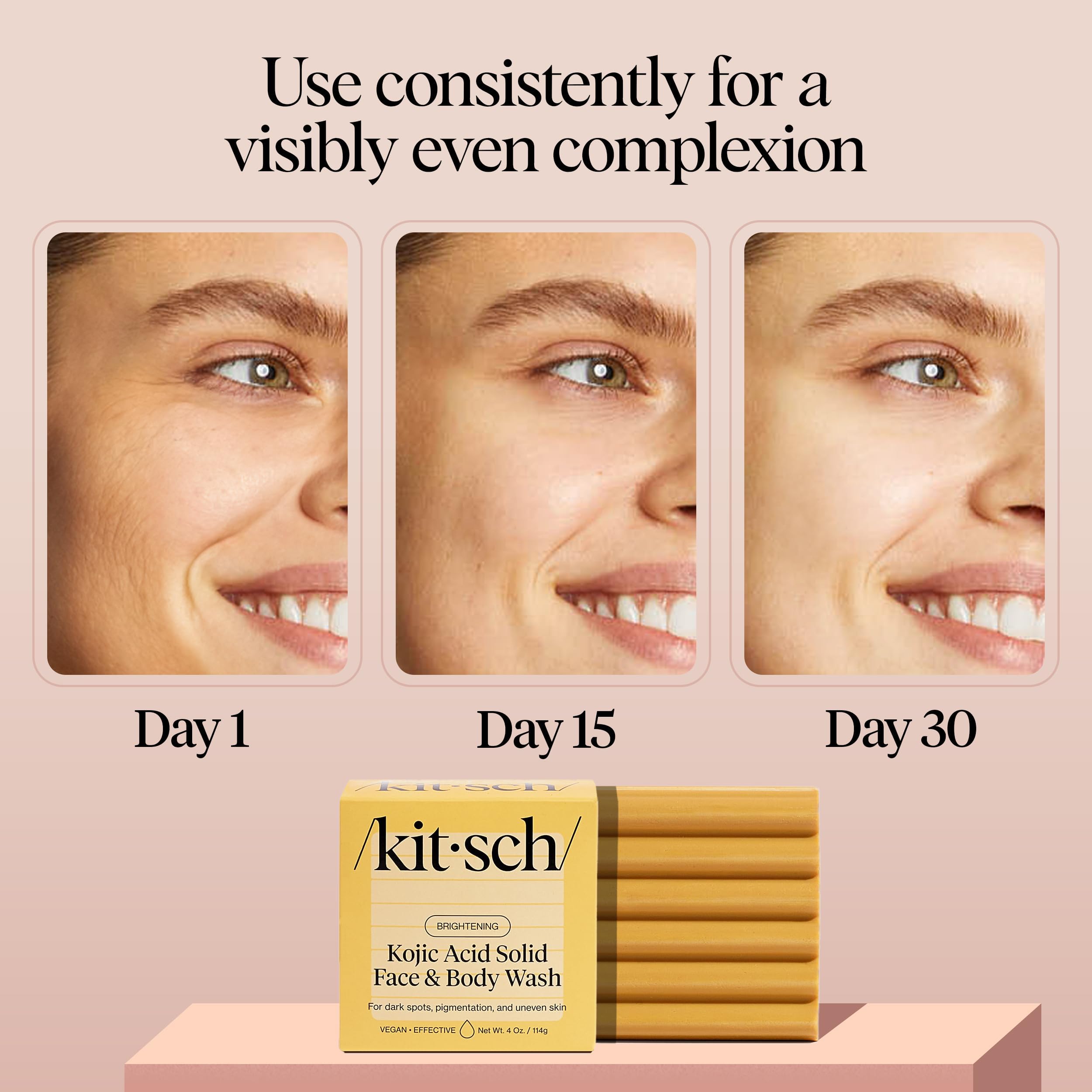 Kitsch Kojic Acid Soap – Turmeric Soap Bar with Hyaluronic Acid & Shea Butter – Brightening & Hydrating Body Wash & Face Wash for Dark Spots