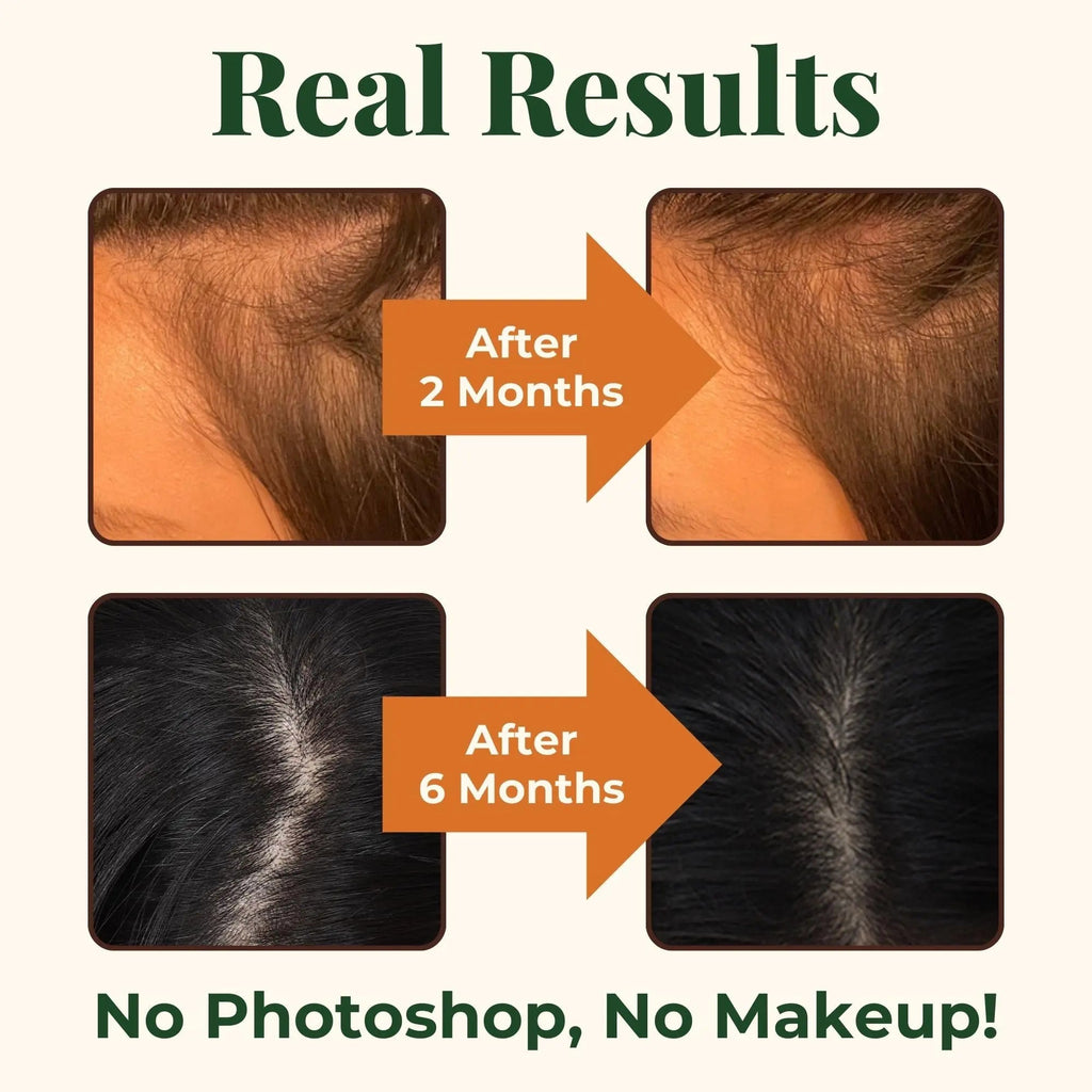 Heebin's Royal Hair, Brows & Lashes, Hair Growth Vitamins with Biotin 4000 mcg, Collagen Heebin's Au supplements