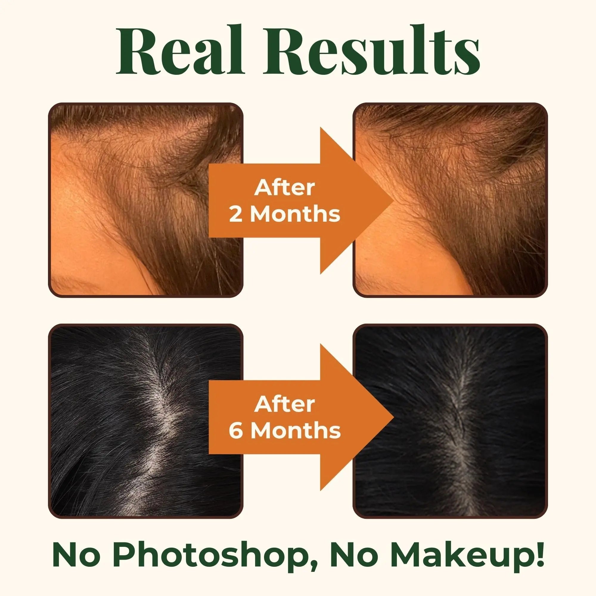 Heebin's Royal Hair, Brows & Lashes, Hair Growth Vitamins with Biotin 4000 mcg, Collagen Heebin's Au supplements