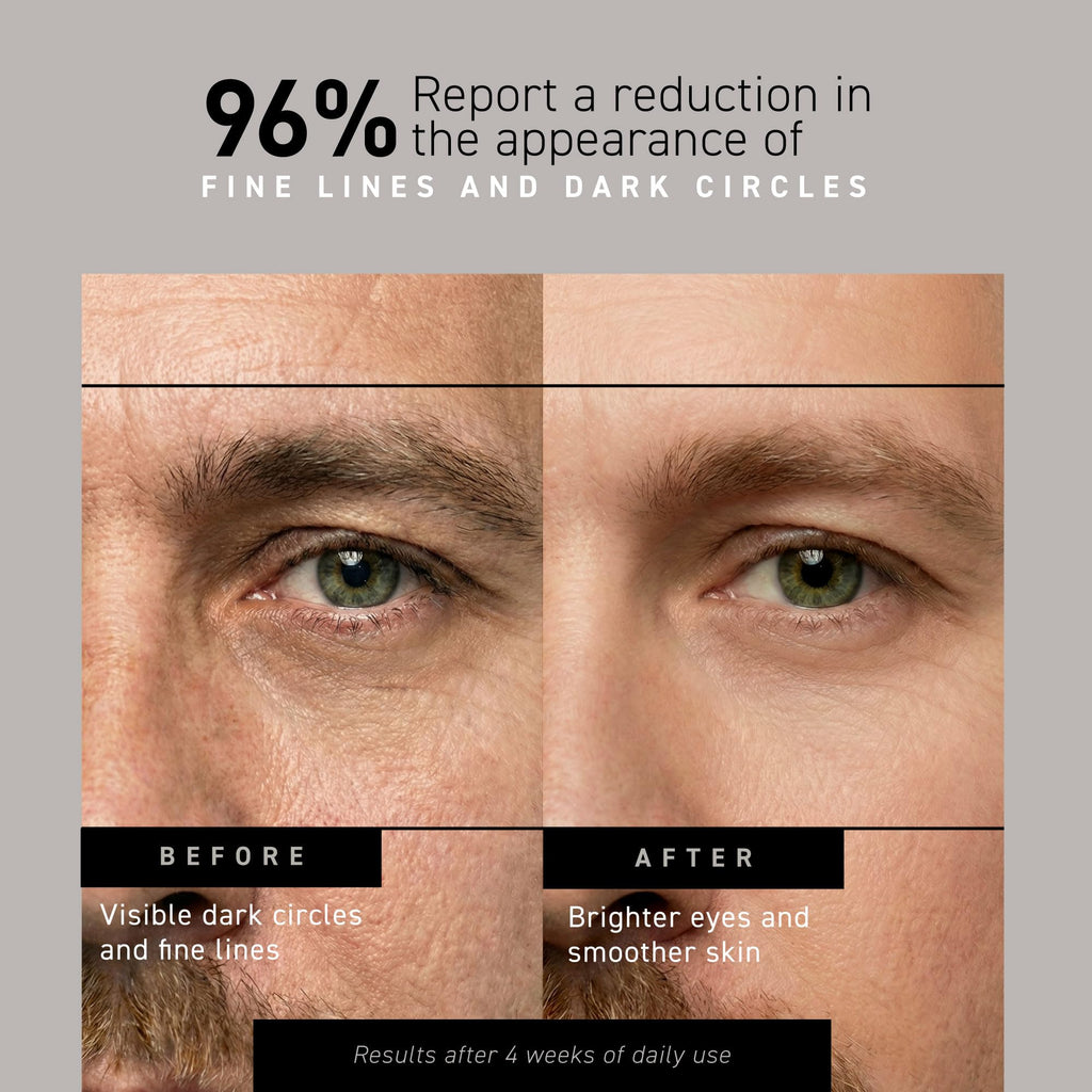 Brickell Men's Restoring Under Eye Cream for Men, Natural and Organic Anti Aging Eye Balm To Reduce Puffiness, Wrinkles, Dark Circles