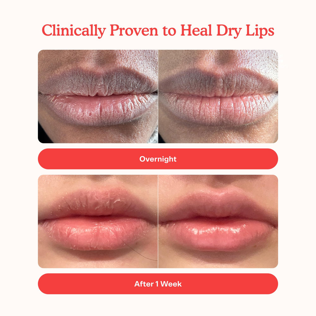 Tower 28 LipSoftie Tinted Lip Balm Treatment - Hydrating Glossy Balm + Overnight Lip Mask