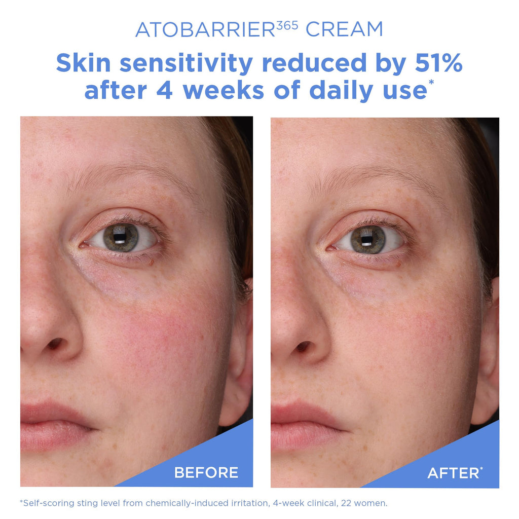 AESTURA ATOBARRIER365 Cream with Ceramides, Korean Face Moisturizer for Barrier Repair | 120H lasting Hydration, Ceramide Capsules