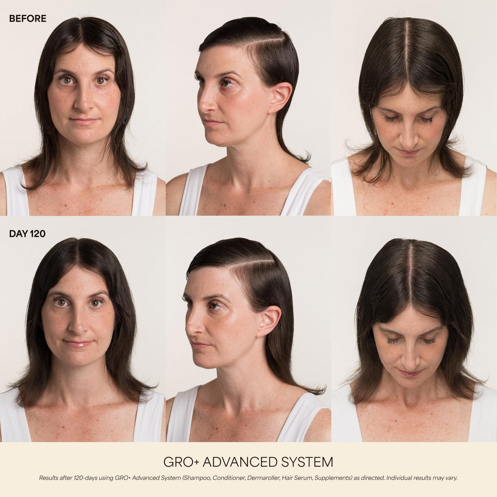 VEGAMOUR GRO+ Advanced Hair Growth Vitamin Supplements - Boosts Hair Growth & Density - 30 Pill Packs/Box VEGAMOUR Au supplements