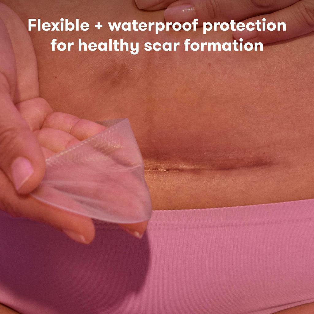 Frida Mom C-Section Silicone Strips, C-Section Recovery Must Have Scar Patches, Reusable Medical Grade Treatment