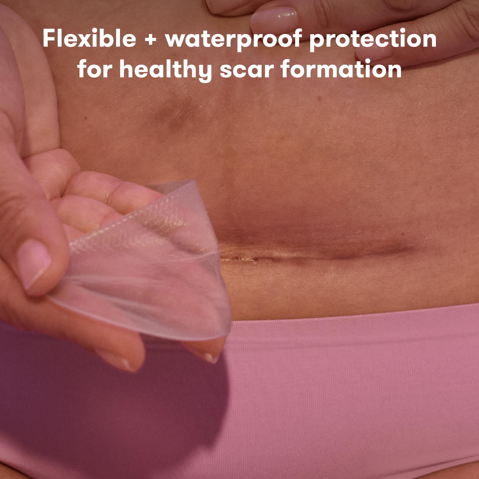 Frida Mom C-Section Silicone Strips, C-Section Recovery Must Have Scar Patches, Reusable Medical Grade Treatment