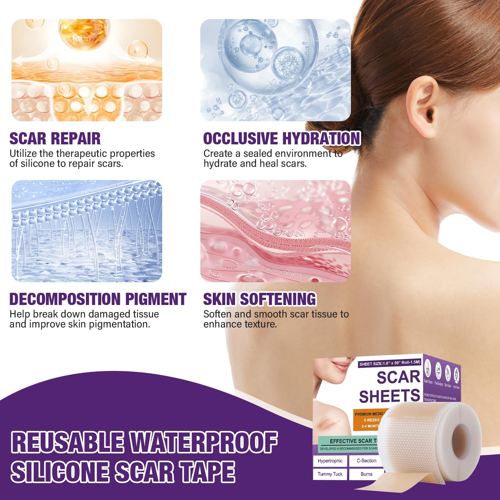 Silicone Scar Sheets,Silicone Scar Tape,Silicone Scar Removal Strips for Surgical,C-Section,Tummy Tuck,Keloid Scars