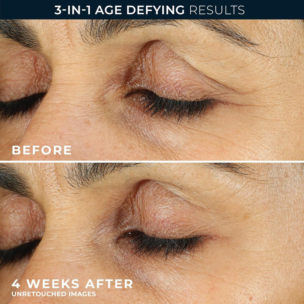 RoC Retinol Correxion Under Eye Cream for Dark Circles & Puffiness, Daily Wrinkle Cream