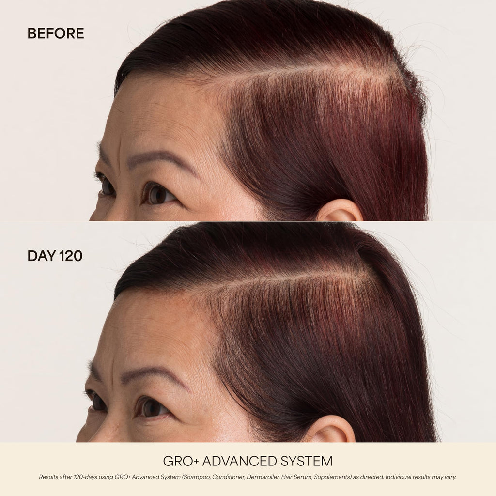 VEGAMOUR GRO+ Advanced Hair Growth Vitamin Supplements - Boosts Hair Growth & Density - 30 Pill Packs/Box VEGAMOUR Au supplements