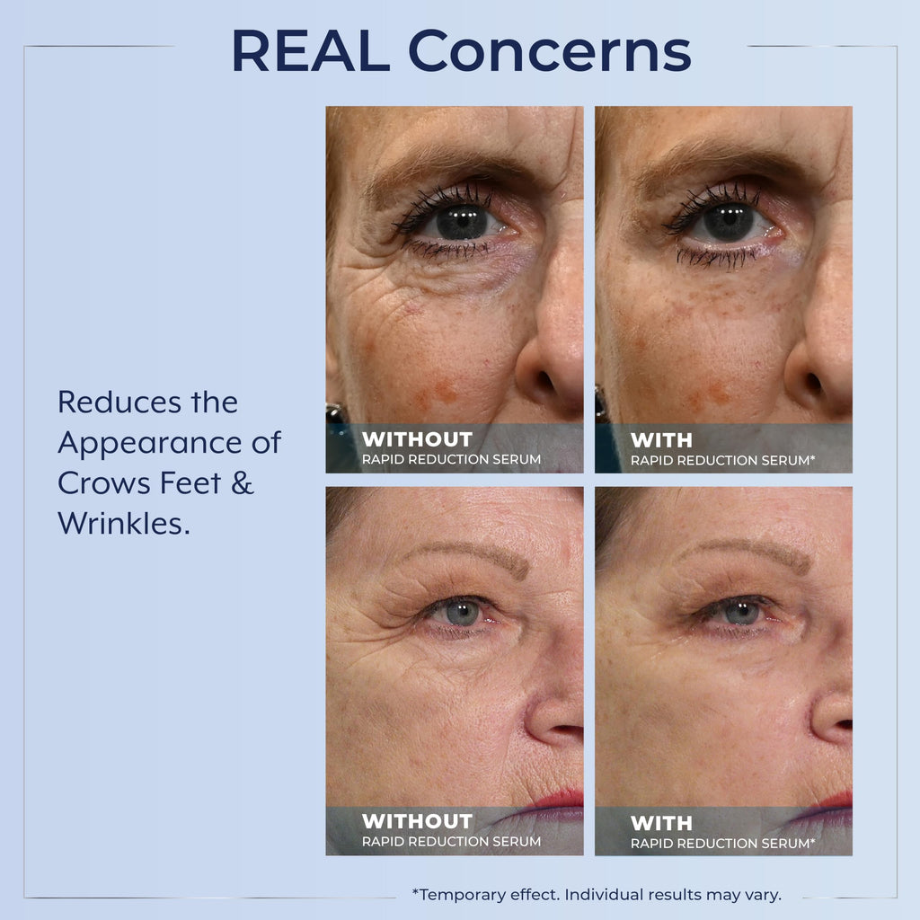 Plexaderm Rapid Reduction Eye Serum - Visibly Reduces Under-Eye Bags, Wrinkles, Dark Circles, Fine Lines & Crow's Feet Instantly